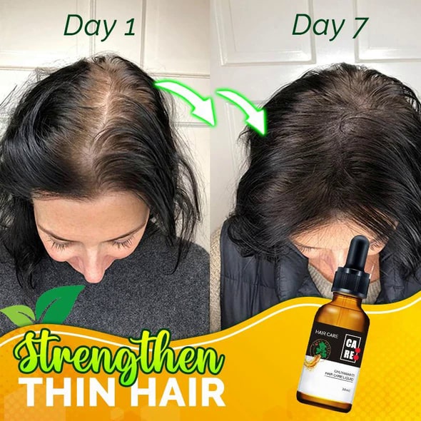 Siero per capelli forti 10X-Regro