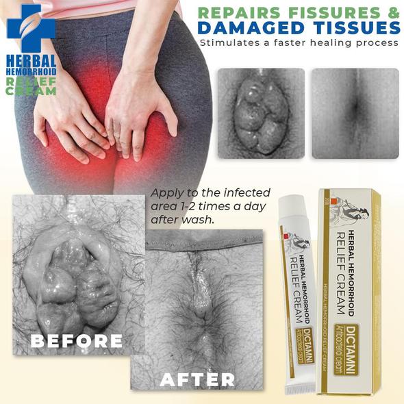 Hemorelief Unguento per il trattamento delle emorroidi - immagine 3