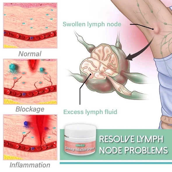Crema riducente per le maniche - immagine 3