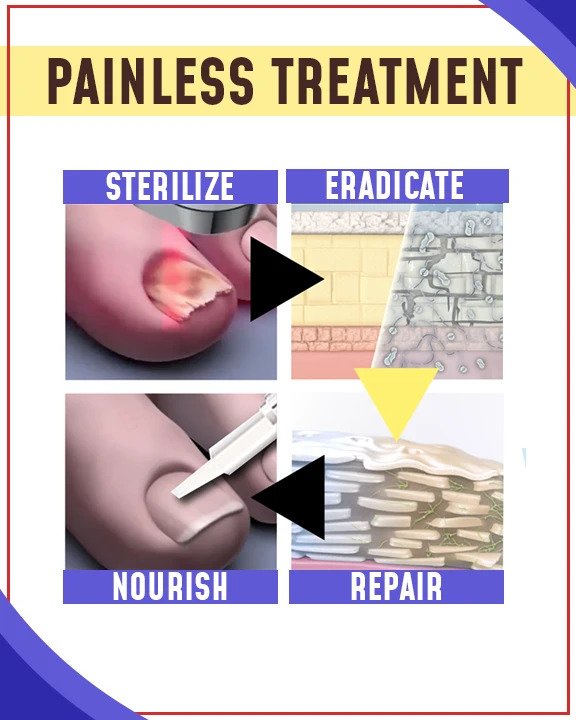 Set per trattamenti antifungini con luce blu - immagine 2