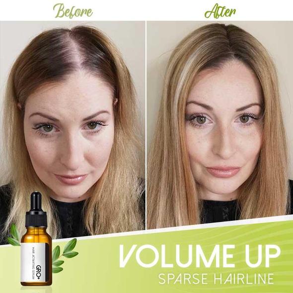 Siero attivante per capelli Gro+ - immagine 4