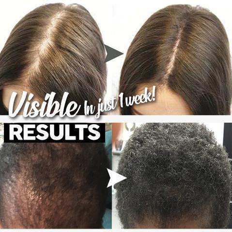 Shampoo solido per la crescita dei capelli - immagine 4