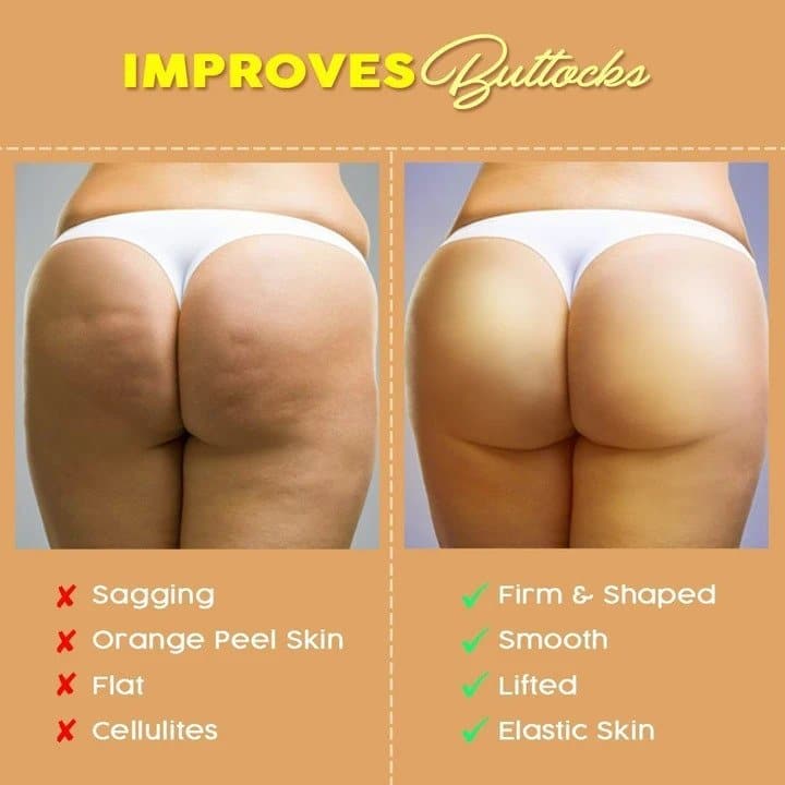 Patch modellanti per il sollevamento dei glutei (6 pezzi/set) - immagine 4