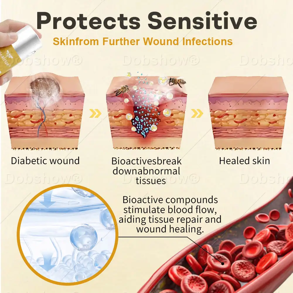 GlucoShield Spray per ferite al veleno d'api - immagine 3