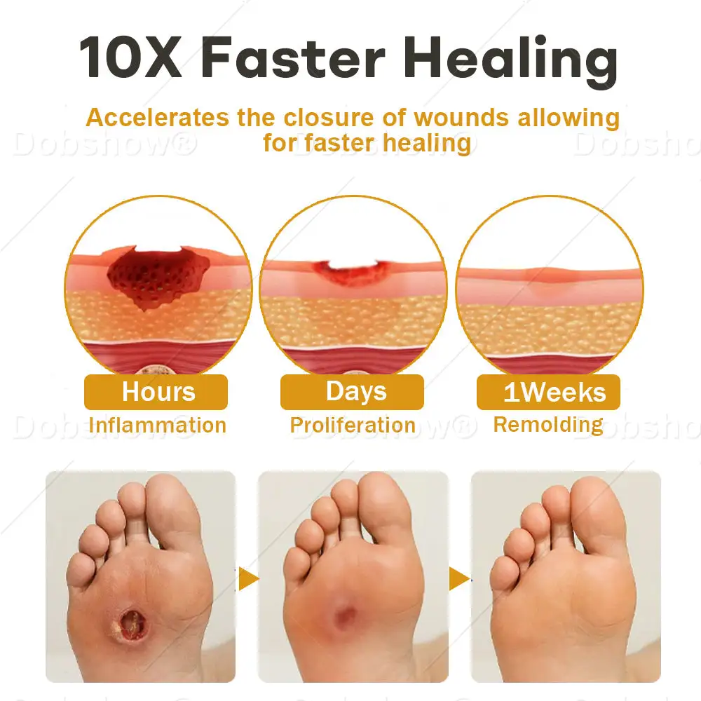 GlucoShield Spray per ferite al veleno d'api - immagine 4