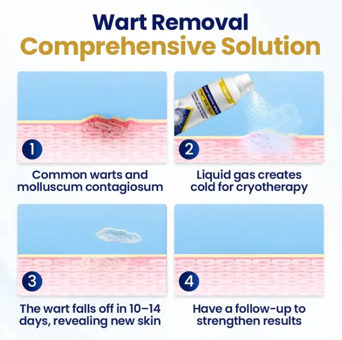 Spray rinnovante per le protuberanze Chillique - immagine 3