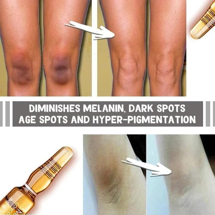 Siero sbiancante in fiala senza macchia (set da 7) - immagine 3